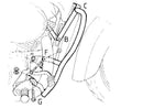 Honda VT 750 C2 [1997-2001] - motor protection bar-1